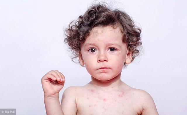 春天传染病高发，病毒容易侵袭孩子，妈妈巧识水痘，防止宝宝中招